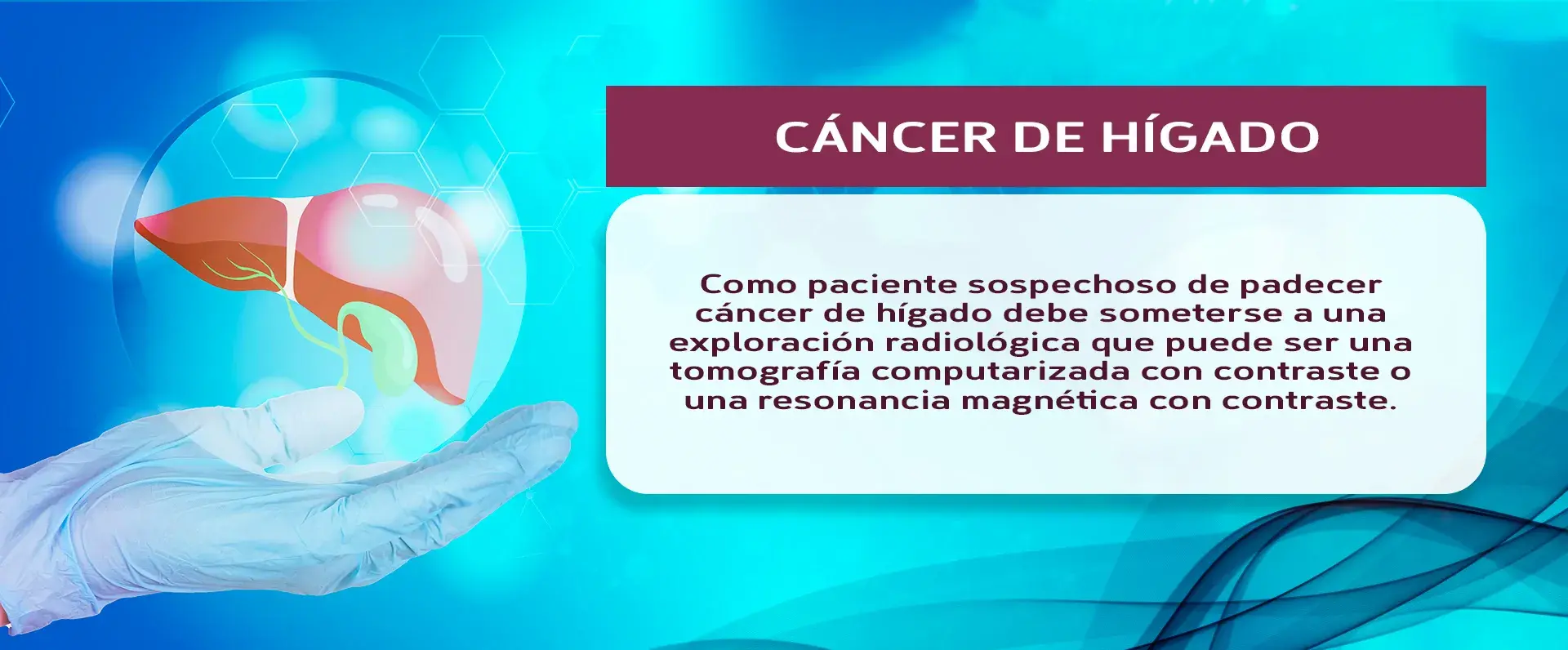 La tomografía computarizada con contraste o la resonancia magnética son las pruebas para saber si se padece de cáncer de hígado