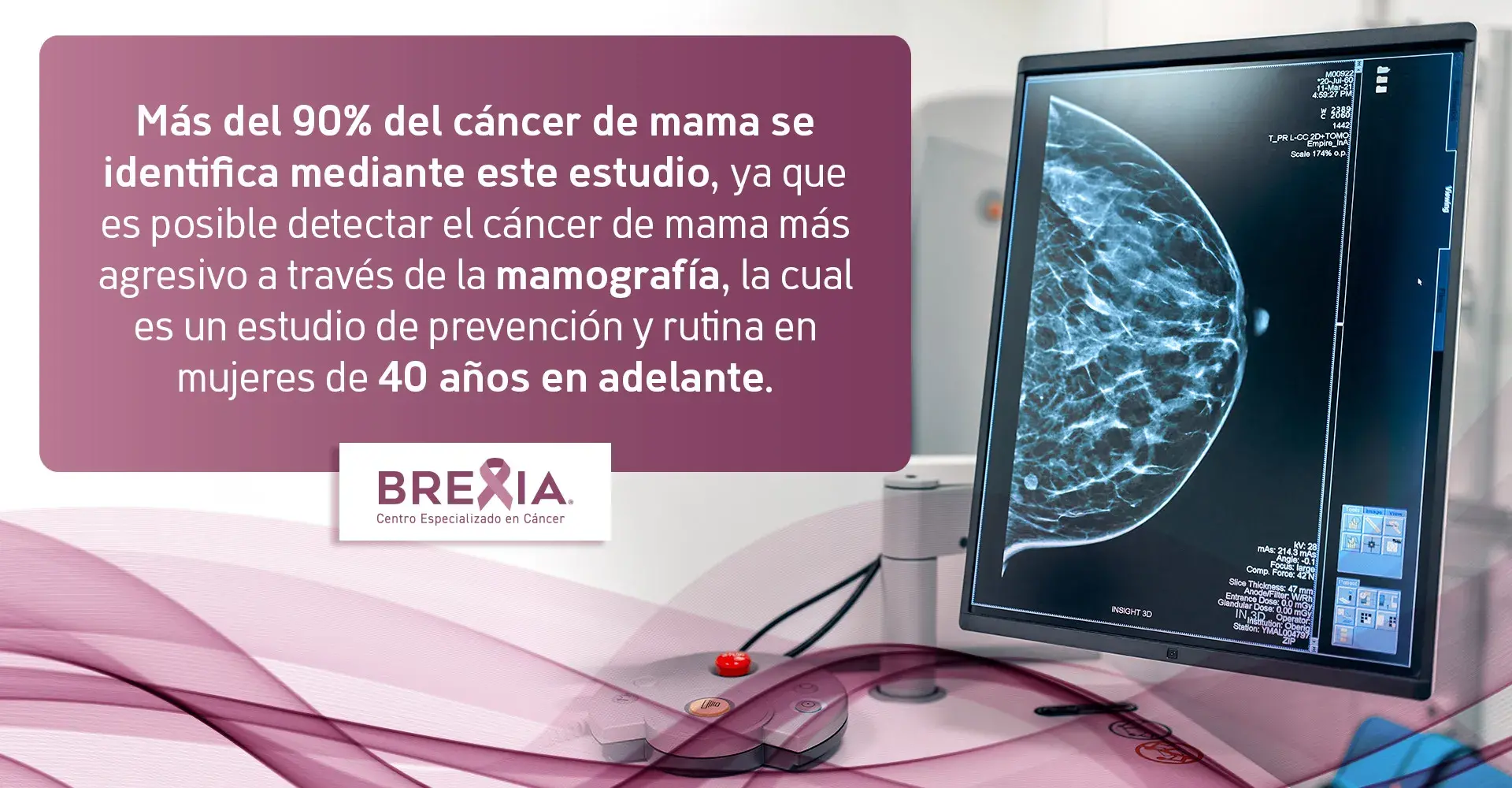 Mediante la mamografía, prueba diagnóstica de imagen, se identifica 90 % del cáncer de mama.