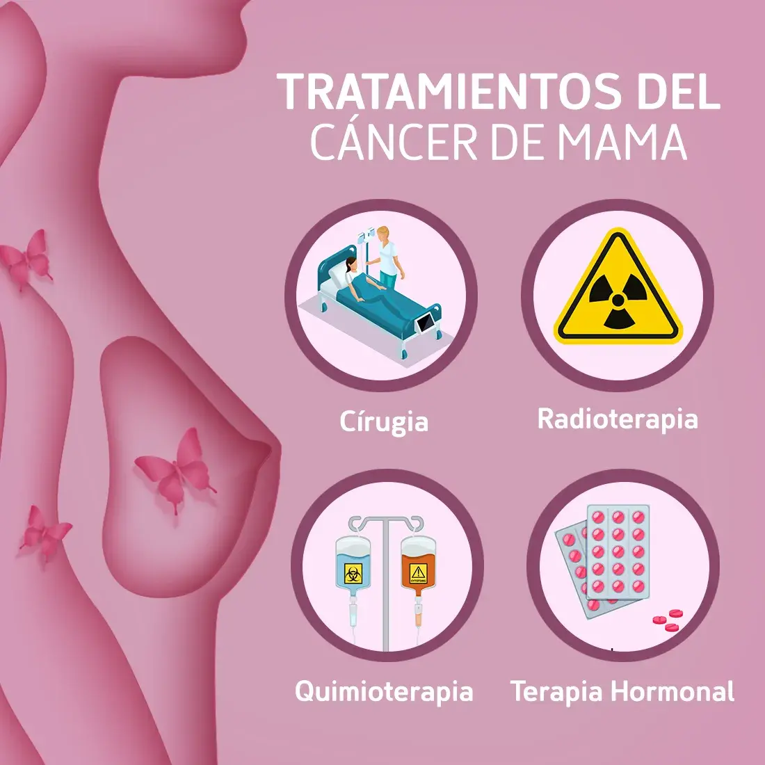 Tipos de tratamientos del cáncer de mama (cirugía, radioterpia, quimioterapia, terapia hormonal)