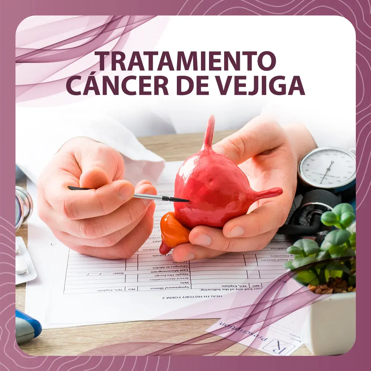 Tratamiento cáncer de vejiga.