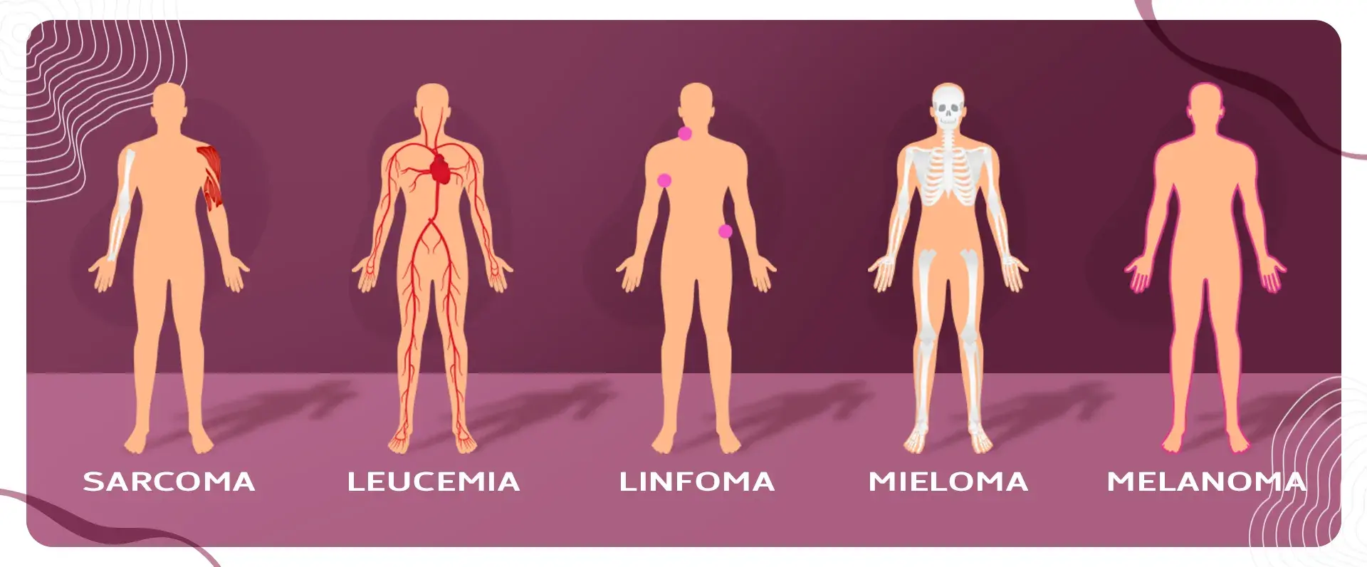 El cáncer es considerado como un grupo de enfermedades porque se da en varias partes del cuerpo.s